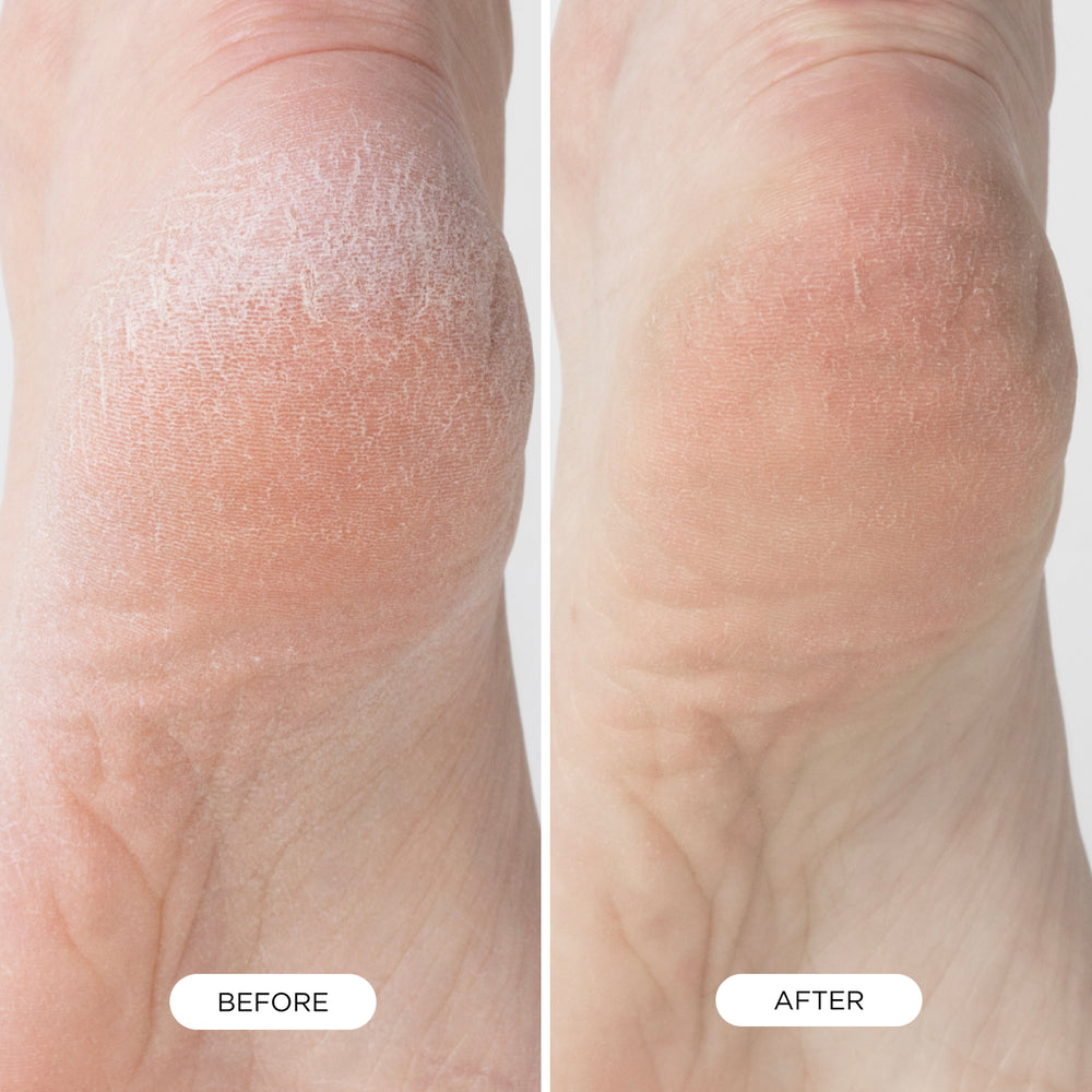 Foot Smooth Enzymatic Scrub, view 4