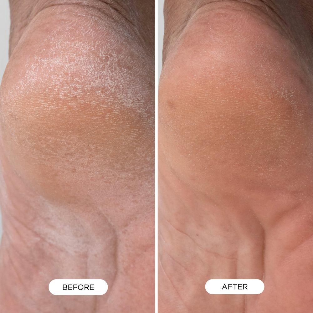 Foot Smooth Enzymatic Scrub, view 3